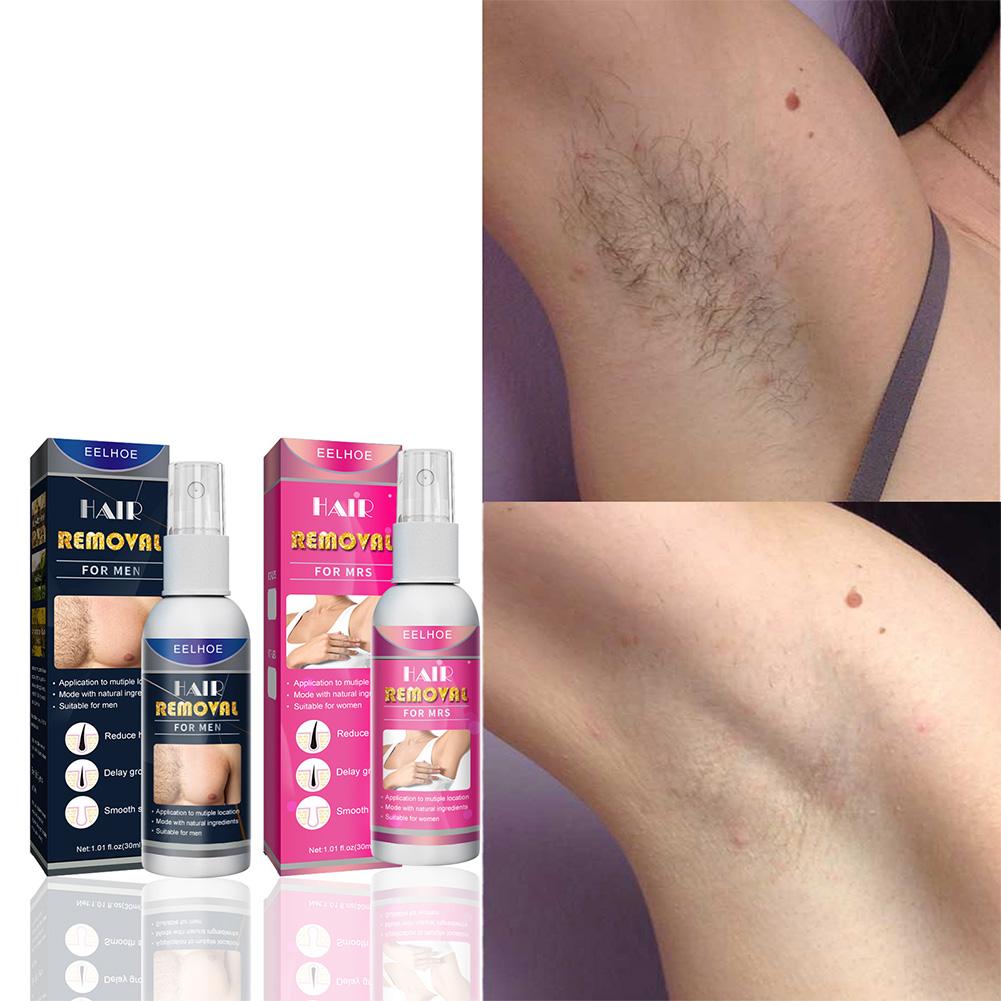 1/2PCS Super Natural Painless  – Hair Care China Bewertung und Preis